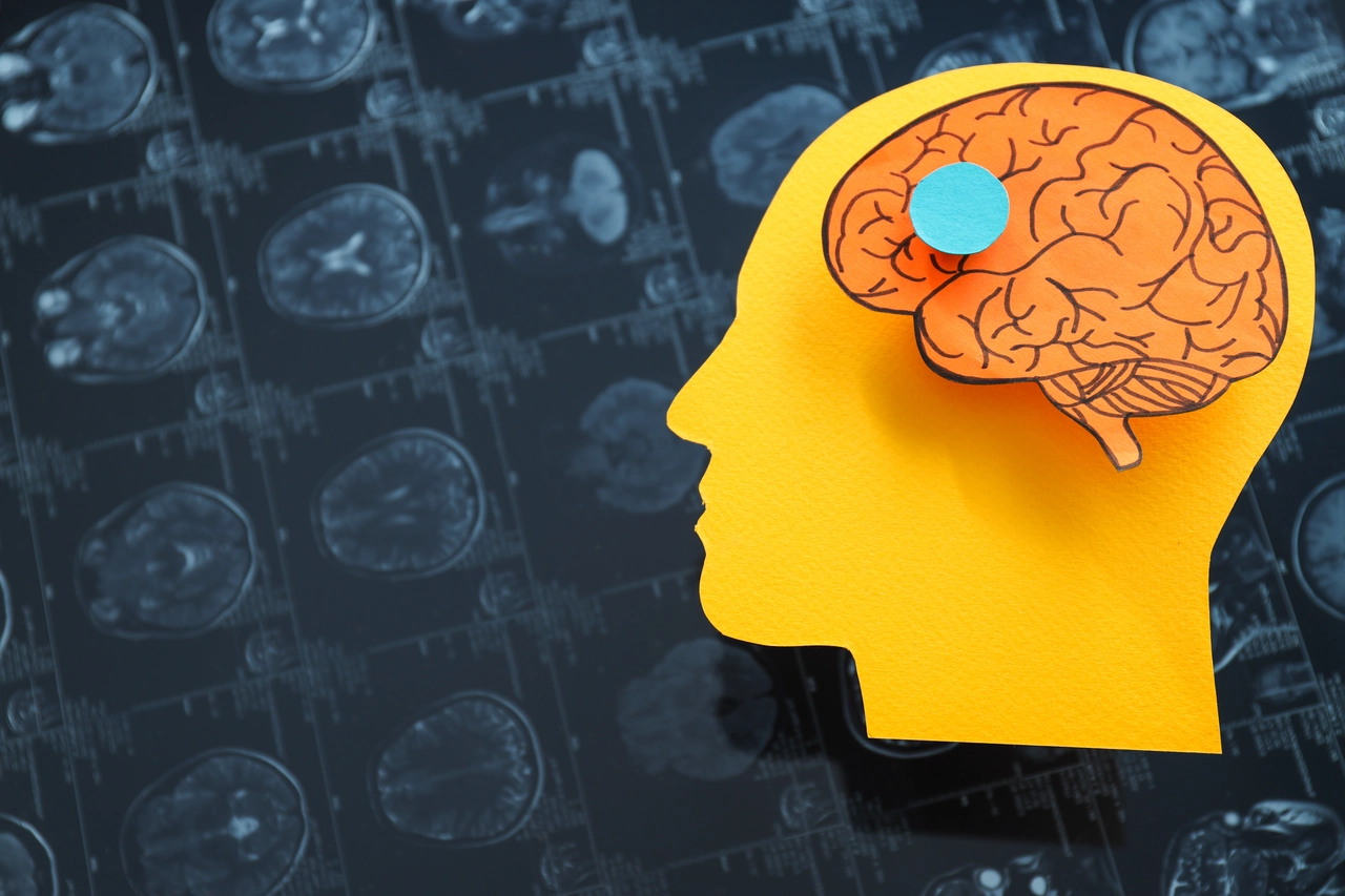 Il trucco per mantenere la memoria giovane: il consiglio dei neurologi per la primavera Il trucco per mantenere la memoria giovane: il consiglio dei neurologi per la primavera